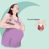 دانستنی های تیروئید در حاملگی